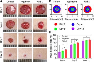 Conductive Adhesive and Antibacterial Zwitterionic Hydrogel Dressing for Therapy of Full-Thickness Skin Wounds